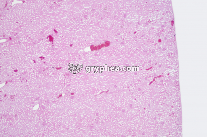 Rein CT zone corticale x10 - gryphea.com